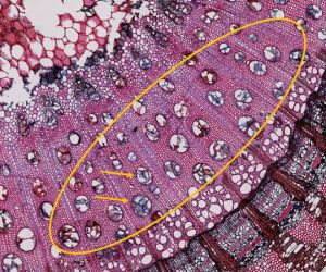 Angriff und Verteidigung